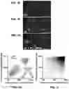 Fig. 03 - Compositions and Methods for Identifying and Treating Dystonia Disorders