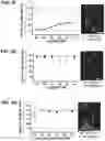 Fig. 08 - Compositions and Methods for Identifying and Treating Dystonia Disorders