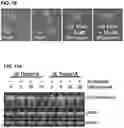 Fig. 22 - Compositions and Methods for Identifying and Treating Dystonia Disorders