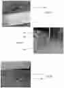 Fig. 08 - WOUND TREATMENTS AND METHODS OF STABILIZING, PROTECTING, AND TREATING A WOUND