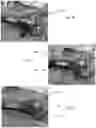 Fig. 09 - WOUND TREATMENTS AND METHODS OF STABILIZING, PROTECTING, AND TREATING A WOUND