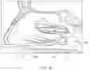 Fig. 09 - NASAL NEUROMODULATION DEVICES AND METHODS