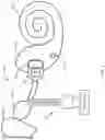 Fig. 04 - Cochlear implant system with electrode impedance diagnostics