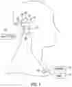 Fig. 05 - Cochlear implant system with electrode impedance diagnostics