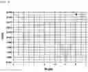 Fig. 08 - Method and device for evaluating dispersion of binder in electrode mixture layer