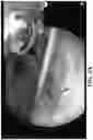 Fig. 04 - System and method for teaching a surgical procedure