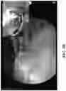 Fig. 05 - System and method for teaching a surgical procedure
