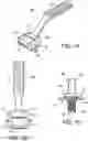 Fig. 02 - Bone cutting guides