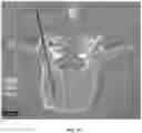 Fig. 06 - Systems and methods for displaying guidance images with spatial annotations during a guided medical procedure