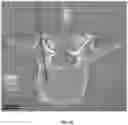Fig. 08 - Systems and methods for displaying guidance images with spatial annotations during a guided medical procedure