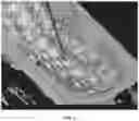 Fig. 09 - Systems and methods for displaying guidance images with spatial annotations during a guided medical procedure