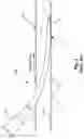 Fig. 02 - CATHETER