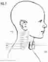 Fig. 09 - NERVE STIMULATION THERAPY FOR MAINTAINING TELOMERE LENGTHS