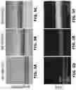 Fig. 06 - Sorting Biological and Non-Biological Moieties Using Magnetic Levitation