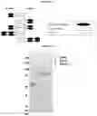 Fig. 02 - SERPIN FUSION POLYPEPTIDES AND METHODS OF USE THEREOF