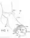 Fig. 02 - Open toe sock with toe anchor