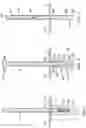 Fig. 02 - Expandable metal for anchoring posts