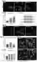 Fig. 03 - COMPOSITION AND METHOD FOR INHIBITING BORC COMPLEX TO TREAT CANCERS WITH NF1 DEFICIENCY AND DYSREGULATED RAS SIGNALING
