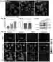 Fig. 04 - COMPOSITION AND METHOD FOR INHIBITING BORC COMPLEX TO TREAT CANCERS WITH NF1 DEFICIENCY AND DYSREGULATED RAS SIGNALING