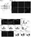 Fig. 06 - COMPOSITION AND METHOD FOR INHIBITING BORC COMPLEX TO TREAT CANCERS WITH NF1 DEFICIENCY AND DYSREGULATED RAS SIGNALING