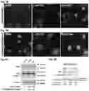 Fig. 08 - COMPOSITION AND METHOD FOR INHIBITING BORC COMPLEX TO TREAT CANCERS WITH NF1 DEFICIENCY AND DYSREGULATED RAS SIGNALING