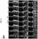 Fig. 06 - Method and device for generating fat suppression magnetic resonance image using generative adversarial neural network based on the Bloch equation