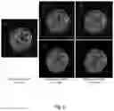 Fig. 06 - Magnetic resonance imaging method and magnetic resonance imaging system