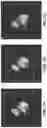 Fig. 08 - Deep learning-assisted image reconstruction for tomographic imaging