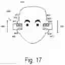 Fig. 08 - Binaural hearing system for providing sensor data indicative of a physiological property, and method of its operation