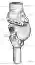 Fig. 03 - ARTIFICIAL KNEE AND PROSTHETIC ASSEMBLY KIT THEREFOR