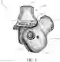 Fig. 04 - ARTIFICIAL KNEE AND PROSTHETIC ASSEMBLY KIT THEREFOR