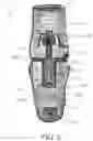 Fig. 06 - ARTIFICIAL KNEE AND PROSTHETIC ASSEMBLY KIT THEREFOR