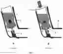 Fig. 02 - DEVICE, METHODS AND USES FOR TREATING ANAPHYLAXIS