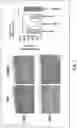 Fig. 08 - METHODS AND COMPOSITIONS FOR TREATMENT OF NEURODEGENERATION