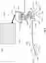 Fig. 06 - MULTI-SENSOR CATHETER FOR RIGHT HEART AND PULMONARY ARTERY CATHETERIZATION