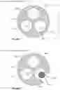Fig. 22 - MULTI-SENSOR CATHETER FOR RIGHT HEART AND PULMONARY ARTERY CATHETERIZATION