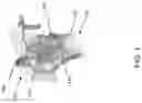Fig. 02 - Intraosseous Catheter Placement Confirmation Device and Method