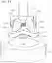 Fig. 02 - System and method for implanting and securing a bioprosthetic device to wet tissue