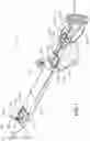 Fig. 02 - INTRAOCULAR LENS INJECTOR