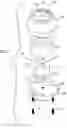 Fig. 02 - Vehicular motor mount