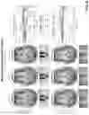 Fig. 07 - Systems and methods for separable motion estimation and correction using rapid three-dimensional (3D) volumetric scout acquisition