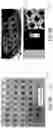Fig. 09 - SYSTEM, METHOD, AND DEVICE FOR PERFORMING ARTHROGRAPHY