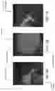 Fig. 15 - SYSTEM, METHOD, AND DEVICE FOR PERFORMING ARTHROGRAPHY