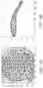Fig. 17 - SYSTEM, METHOD, AND DEVICE FOR PERFORMING ARTHROGRAPHY