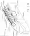Fig. 114 - Electrosurgical techniques for sealing, short circuit detection, and system determination of power level