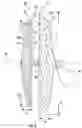 Fig. 03 - DEVICES, SYSTEMS, AND METHODS FOR OCCLUDING AN ANATOMICAL PASSAGE