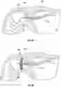 Fig. 06 - DEVICES, SYSTEMS, AND METHODS FOR OCCLUDING AN ANATOMICAL PASSAGE