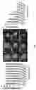 Fig. 02 - ENGINEERED CARTILAGE