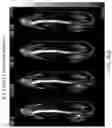 Fig. 51 - LIPOSOMAL SPHERICAL NUCLEIC ACID (SNA) CONSTRUCTS FOR SPLICE MODULATION
