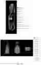 Fig. 53 - LIPOSOMAL SPHERICAL NUCLEIC ACID (SNA) CONSTRUCTS FOR SPLICE MODULATION